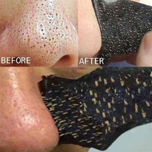 Nose Blackhead Remover Strips Deep Pore Cleansing Oil Control Nose Strips