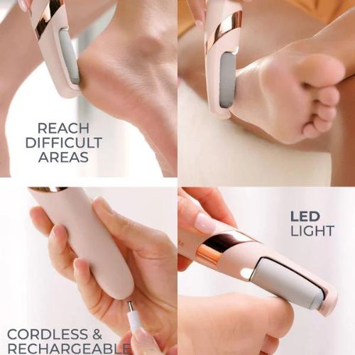 Electric Foot File Callus Remover Pedicure Dead Skin Removal Device